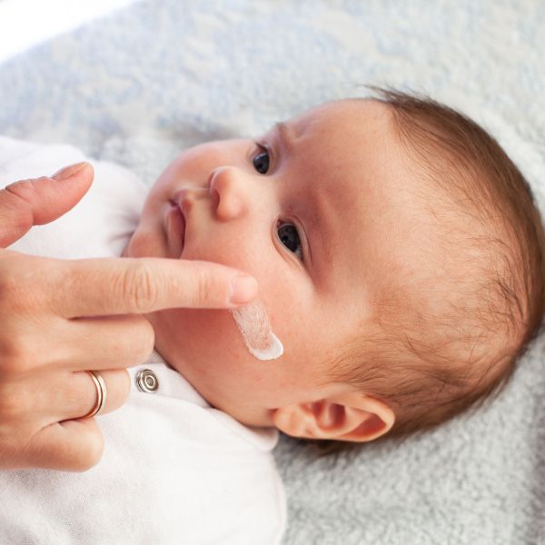 how can i treat my baby's eczema naturally